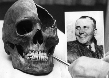 Bormann Skull Bormanns Schädel